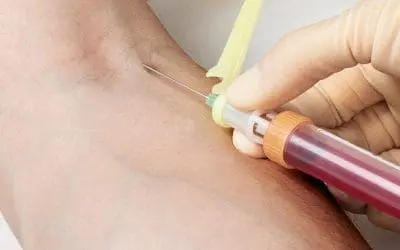 Einladung Präanalytik-Fortbildung